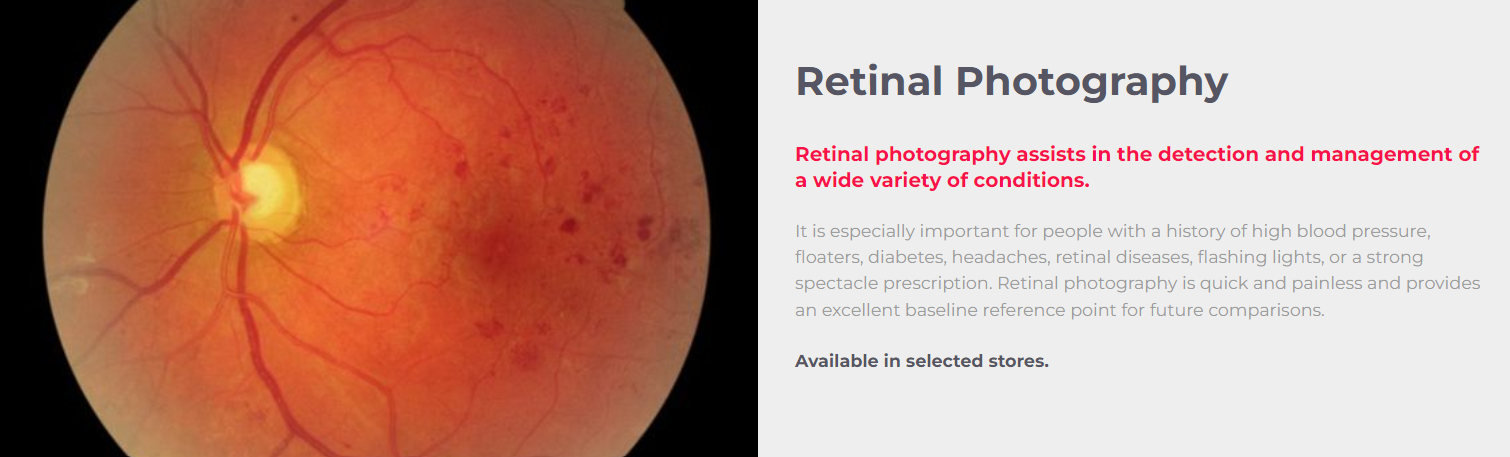 Retinal Photography George